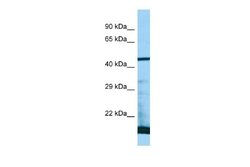 PAAF1 Antibody, Novus Biologicals 100 &mu;L; Unconjugated:Antibodies, Polyclonal